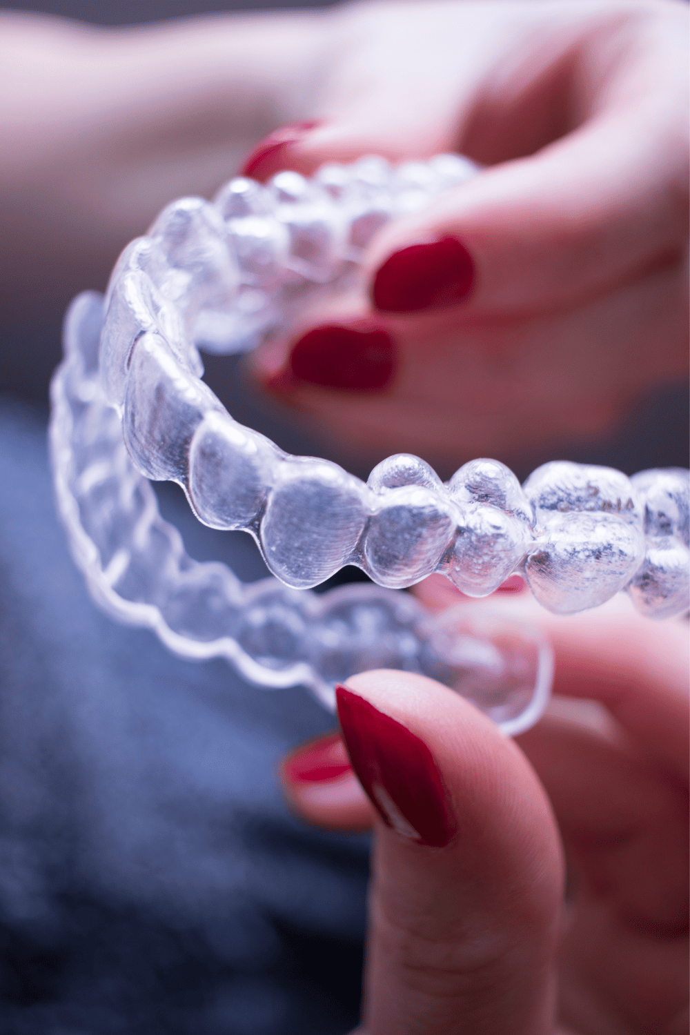 Reinventing Your Smile: The Benefits of Clear Teeth Aligners