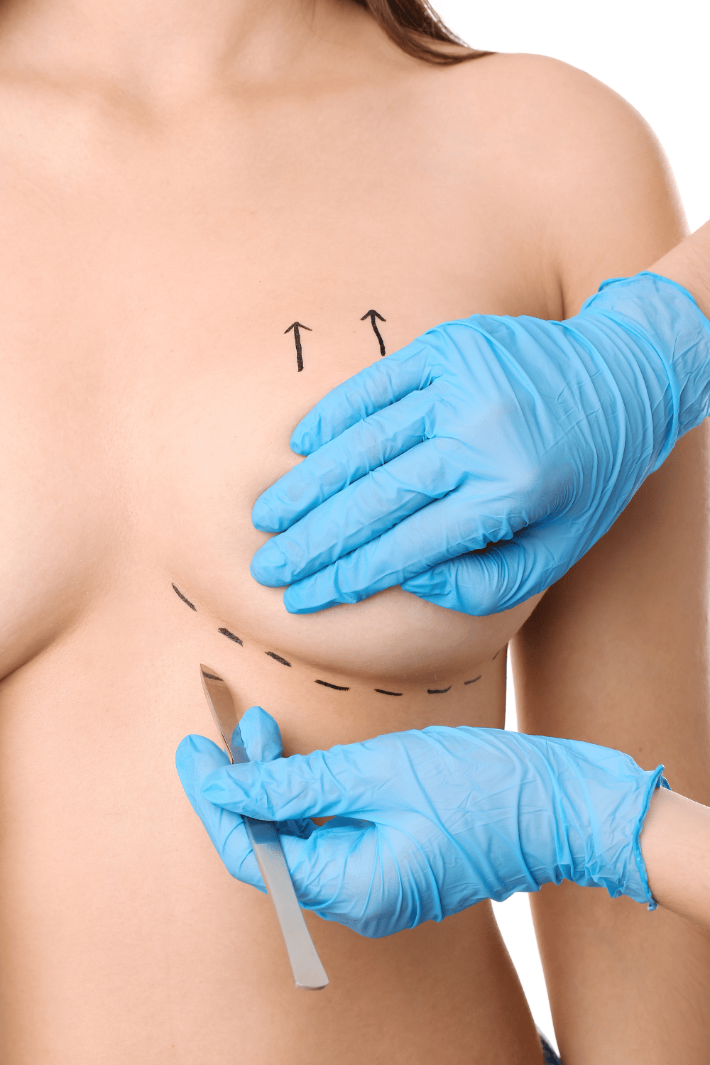 Embrace Confidence: Exploring Breast Augmentation in Sydney