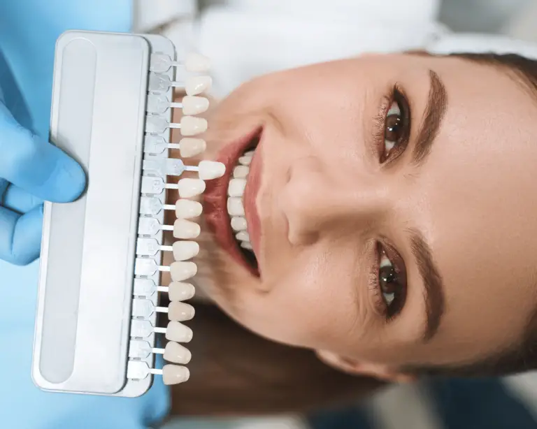 9 Benefits of Dental Veneers in Enhancing Your Smile and Aligning Your Teeth
