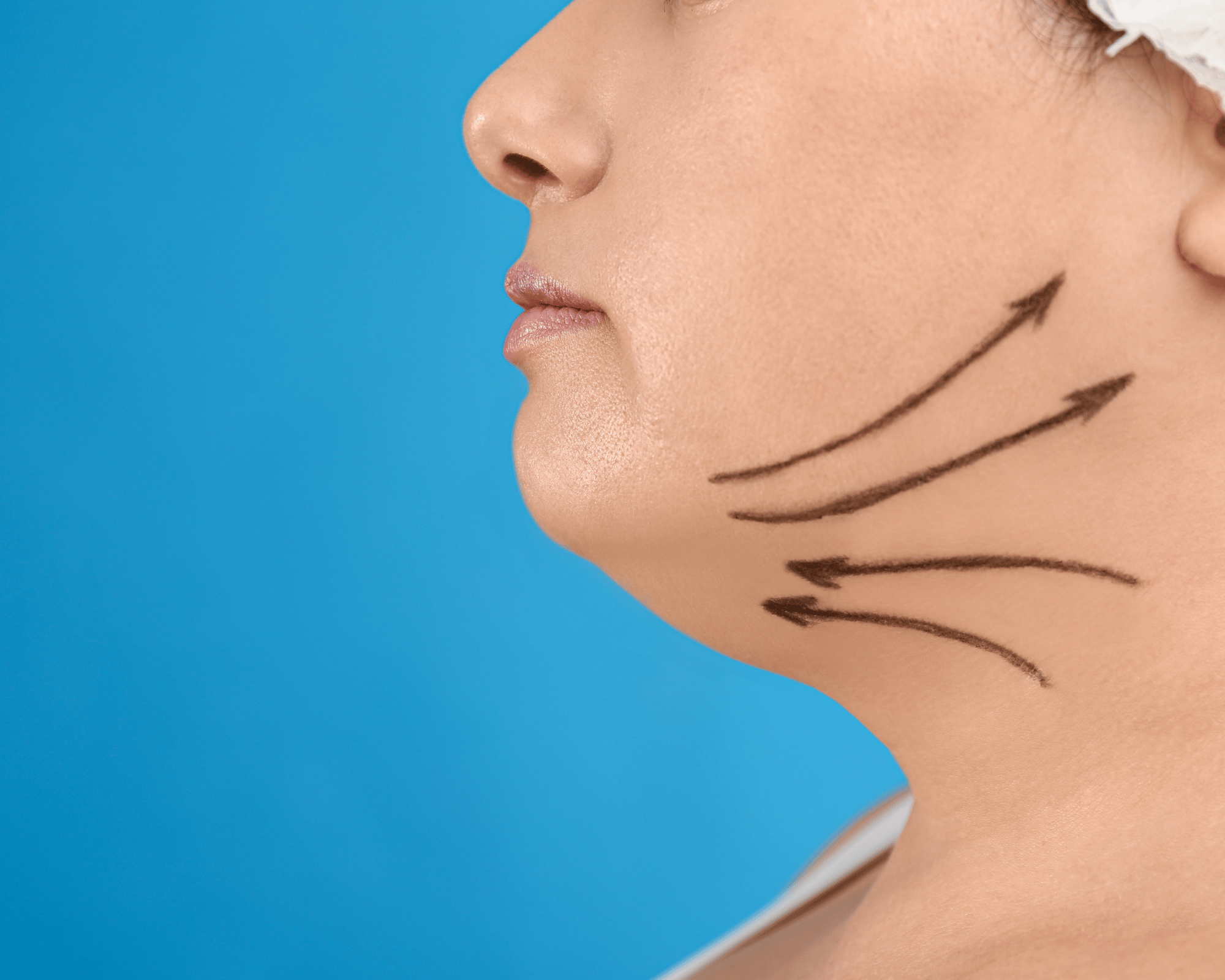 Preparing for Chin Surgery: What to Expect Before and During Your Procedure